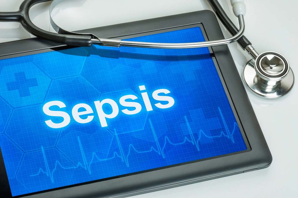 sepsis